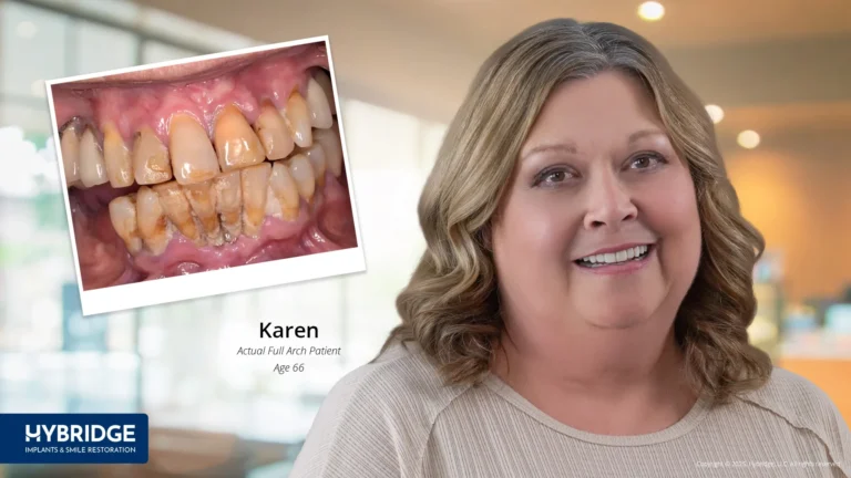 Hybridge Dental Implants Lansing, MI